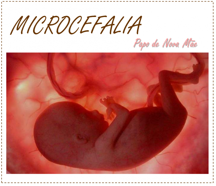 microcefalia.feto_.png
